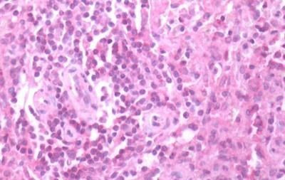 CXCR3 Antibody in Immunohistochemistry (Paraffin) (IHC (P))