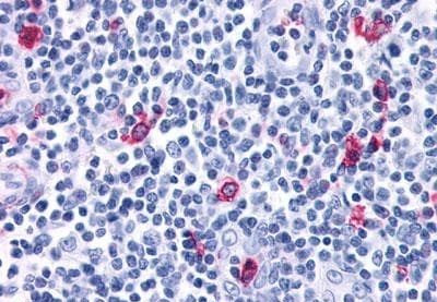 CXCR3 Antibody in Immunohistochemistry (Paraffin) (IHC (P))