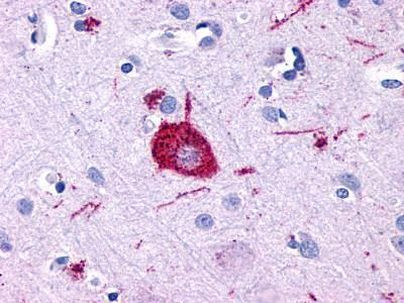 GPR116 Antibody in Immunohistochemistry (Paraffin) (IHC (P))