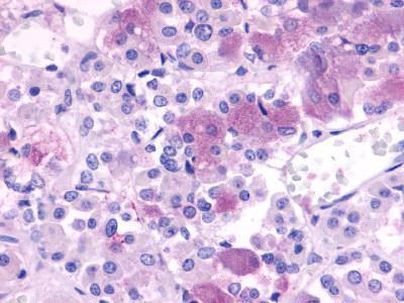 NPBWR1 Antibody in Immunohistochemistry (Paraffin) (IHC (P))