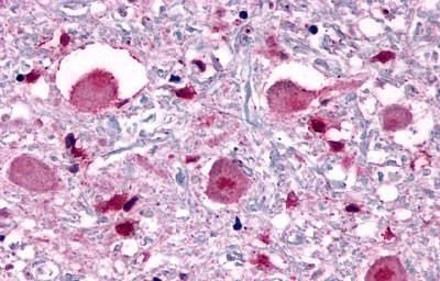 Opsin 3 Antibody in Immunohistochemistry (Paraffin) (IHC (P))