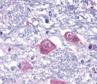 PTH2R Antibody in Immunohistochemistry (Paraffin) (IHC (P))