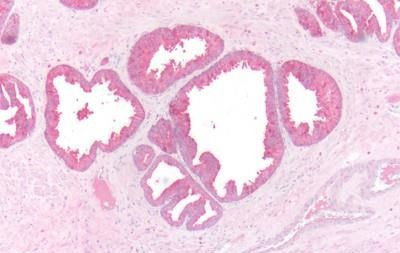 beta-3 Adrenergic Receptor Antibody in Immunohistochemistry (Paraffin) (IHC (P))