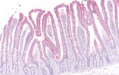 beta-3 Adrenergic Receptor Antibody in Immunohistochemistry (Paraffin) (IHC (P))