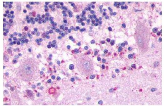 MTNR1B Antibody in Immunohistochemistry (Paraffin) (IHC (P))