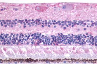 MTNR1B Antibody in Immunohistochemistry (Paraffin) (IHC (P))