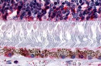 MTNR1B Antibody in Immunohistochemistry (Paraffin) (IHC (P))