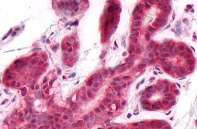 DUSP26 Antibody in Immunohistochemistry (Paraffin) (IHC (P))