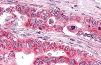 DUSP26 Antibody in Immunohistochemistry (Paraffin) (IHC (P))