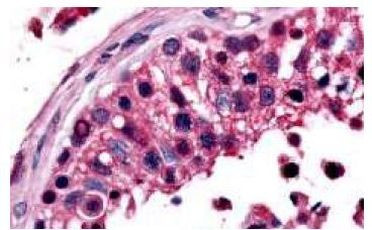 ESRRB Antibody in Immunohistochemistry (Paraffin) (IHC (P))