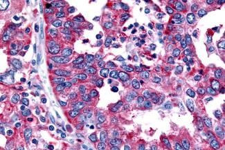 TSH Receptor Antibody in Immunohistochemistry (Paraffin) (IHC (P))