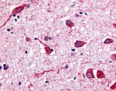 CHRM2 Antibody in Immunohistochemistry (Paraffin) (IHC (P))