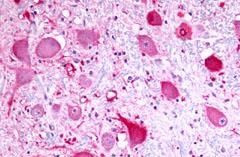 TPRA1 Antibody in Immunohistochemistry (Paraffin) (IHC (P))