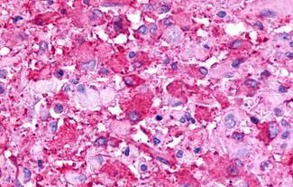 TPRA1 Antibody in Immunohistochemistry (Paraffin) (IHC (P))