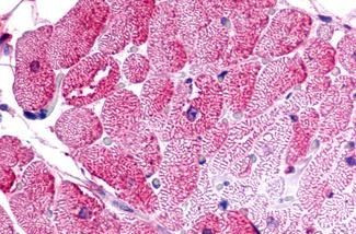 TPRA1 Antibody in Immunohistochemistry (Paraffin) (IHC (P))