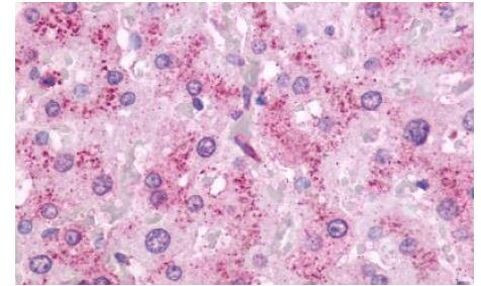 OXER1 Antibody in Immunohistochemistry (Paraffin) (IHC (P))