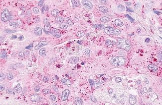 OXER1 Antibody in Immunohistochemistry (Paraffin) (IHC (P))