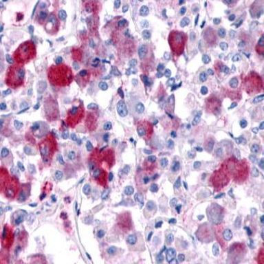 GPR161 Antibody in Immunohistochemistry (Paraffin) (IHC (P))