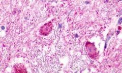 NMUR1 Antibody in Immunohistochemistry (Paraffin) (IHC (P))