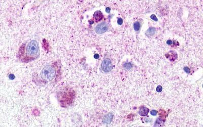 NMUR1 Antibody in Immunohistochemistry (Paraffin) (IHC (P))