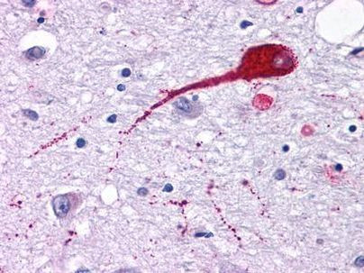 NMUR2 Antibody in Immunohistochemistry (Paraffin) (IHC (P))