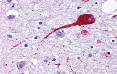 NMUR2 Antibody in Immunohistochemistry (Paraffin) (IHC (P))