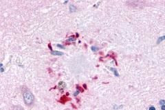 GPR78 Antibody in Immunohistochemistry (Paraffin) (IHC (P))