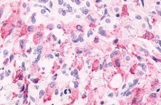 mGluR6 Antibody in Immunohistochemistry (Paraffin) (IHC (P))