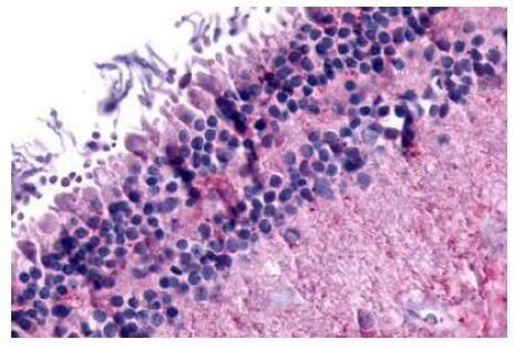 mGluR6 Antibody in Immunohistochemistry (Paraffin) (IHC (P))