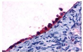 FOXL2 Antibody in Immunohistochemistry (Paraffin) (IHC (P))