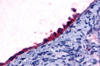 FOXL2 Antibody in Immunohistochemistry (Paraffin) (IHC (P))