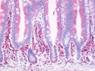 PTGDR Antibody in Immunohistochemistry (Paraffin) (IHC (P))