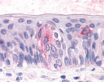 TAS1R3 Antibody in Immunohistochemistry (Paraffin) (IHC (P))