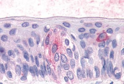 TAS1R3 Antibody in Immunohistochemistry (Paraffin) (IHC (P))