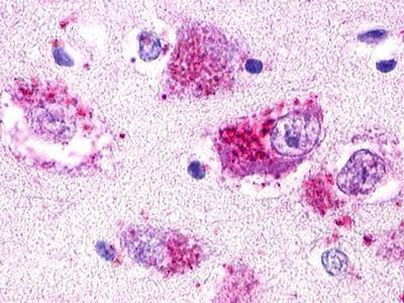 RXFP4 Antibody in Immunohistochemistry (Paraffin) (IHC (P))