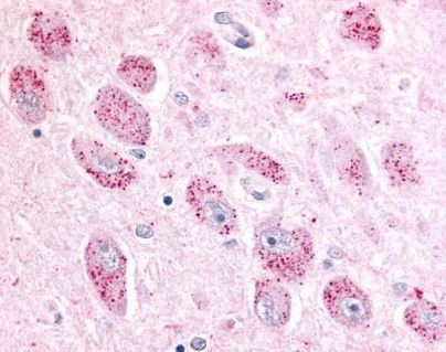 NPBWR2 Antibody in Immunohistochemistry (Paraffin) (IHC (P))