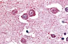 NPBWR2 Antibody in Immunohistochemistry (Paraffin) (IHC (P))