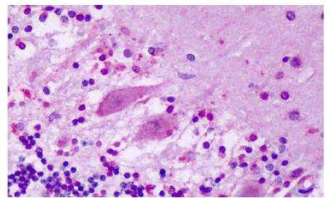 GPR1 Antibody in Immunohistochemistry (Paraffin) (IHC (P))