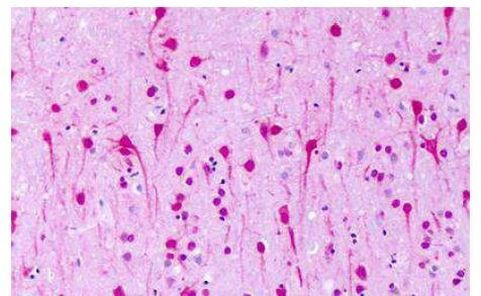 GPR1 Antibody in Immunohistochemistry (Paraffin) (IHC (P))