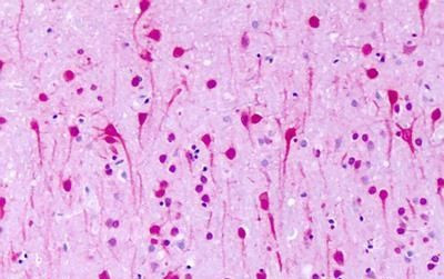 GPR1 Antibody in Immunohistochemistry (Paraffin) (IHC (P))