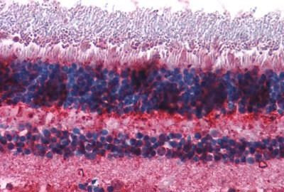 mGluR7 Antibody in Immunohistochemistry (Paraffin) (IHC (P))