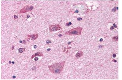 mGluR7 Antibody in Immunohistochemistry (Paraffin) (IHC (P))