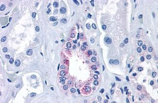 Calcium Sensing Receptor Antibody in Immunohistochemistry (Paraffin) (IHC (P))