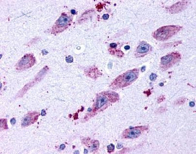 D4 Dopamine Receptor Antibody in Immunohistochemistry (Paraffin) (IHC (P))