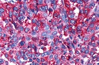 D4 Dopamine Receptor Antibody in Immunohistochemistry (Paraffin) (IHC (P))