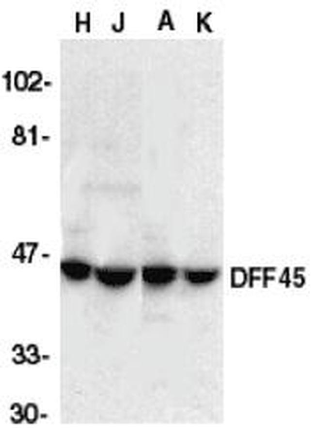 ICAD Antibody in Western Blot (WB)