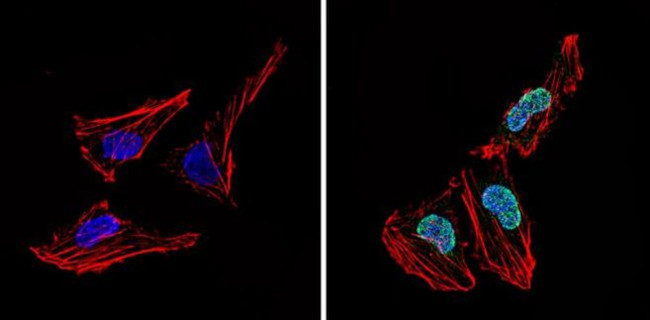 LXR alpha Antibody in Immunocytochemistry (ICC/IF)