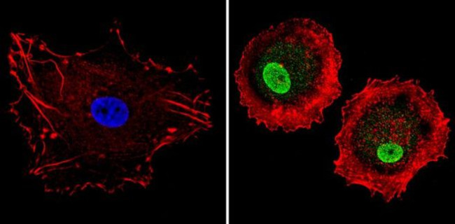 LXR alpha Antibody in Immunocytochemistry (ICC/IF)