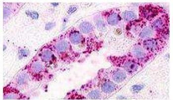 GPRC5D Antibody in Immunohistochemistry (Paraffin) (IHC (P))