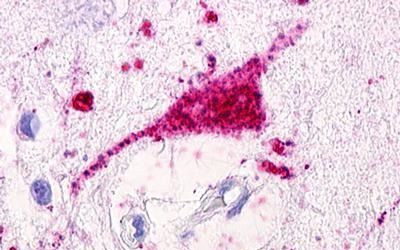 GPRC5D Antibody in Immunohistochemistry (Paraffin) (IHC (P))